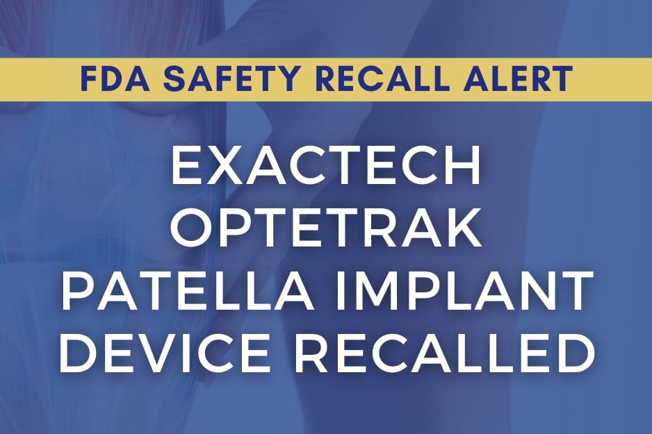 Optetrak Patella Implant Device Exactech Recall